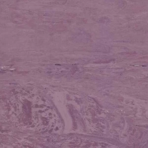 فينيل طبي صيني سمك 2 ملم، بنفسجى، مقاس البلاطة 608 ×608 ملم | mipolam 180 – 2026